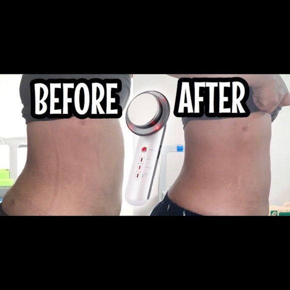 Skin options - Picture 3 of 5